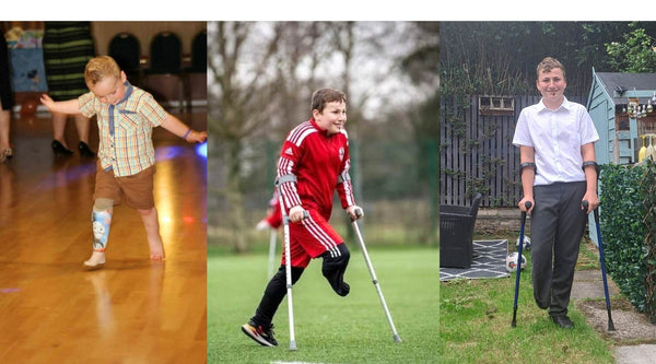 Kicking Goals: Max’s Inspiring Journey as a Child Amputee Footballer